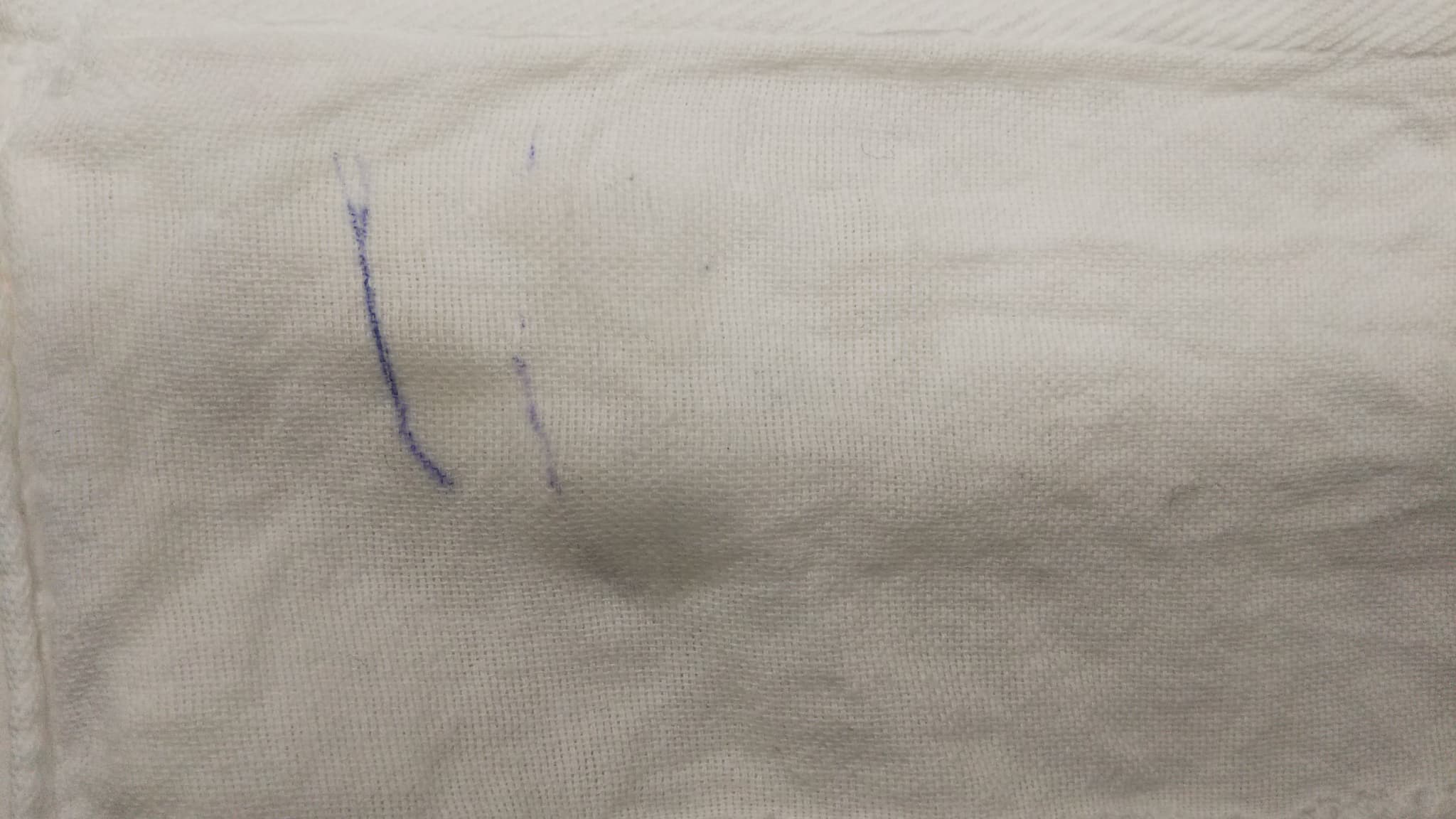 インク染み抜き画像
